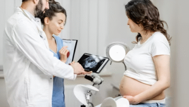 4D Ultrasound